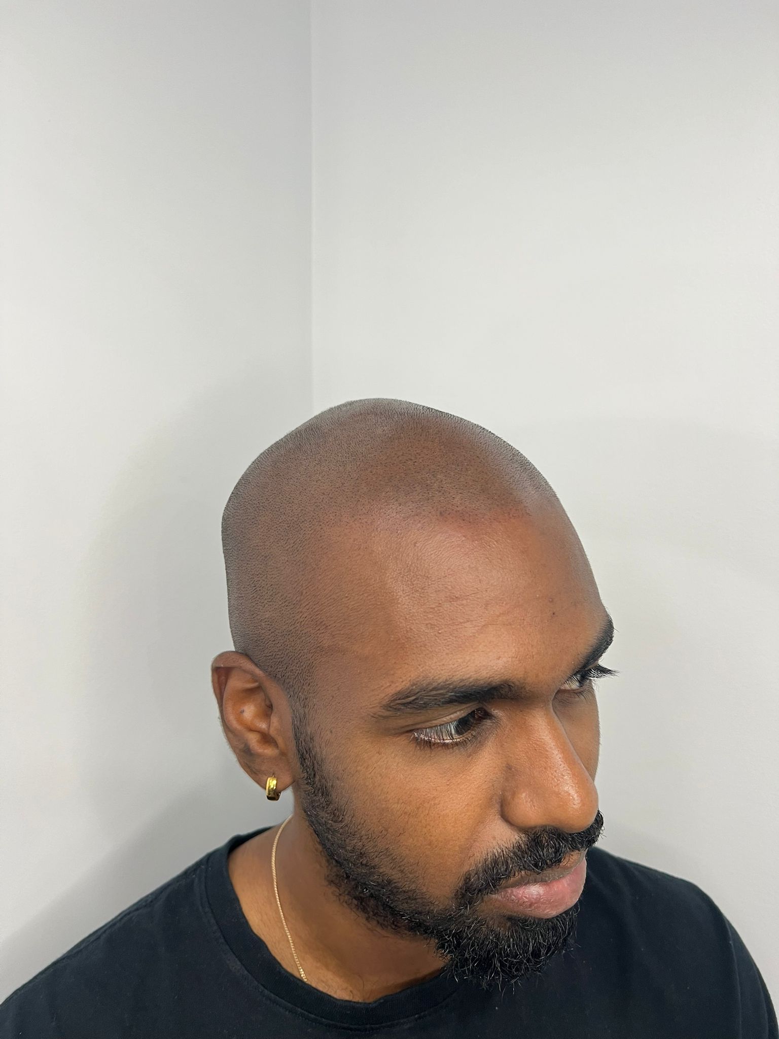 SMP side profile result